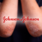 SKN | האם הגלולה החדשה לפסוריאזיס של J&J יכולה לערער את שוק הביולוגיים בהיקף של 100 מיליארד דולר?